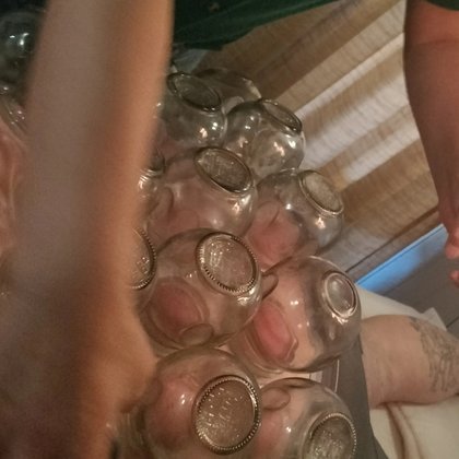 Fire cupping therapy