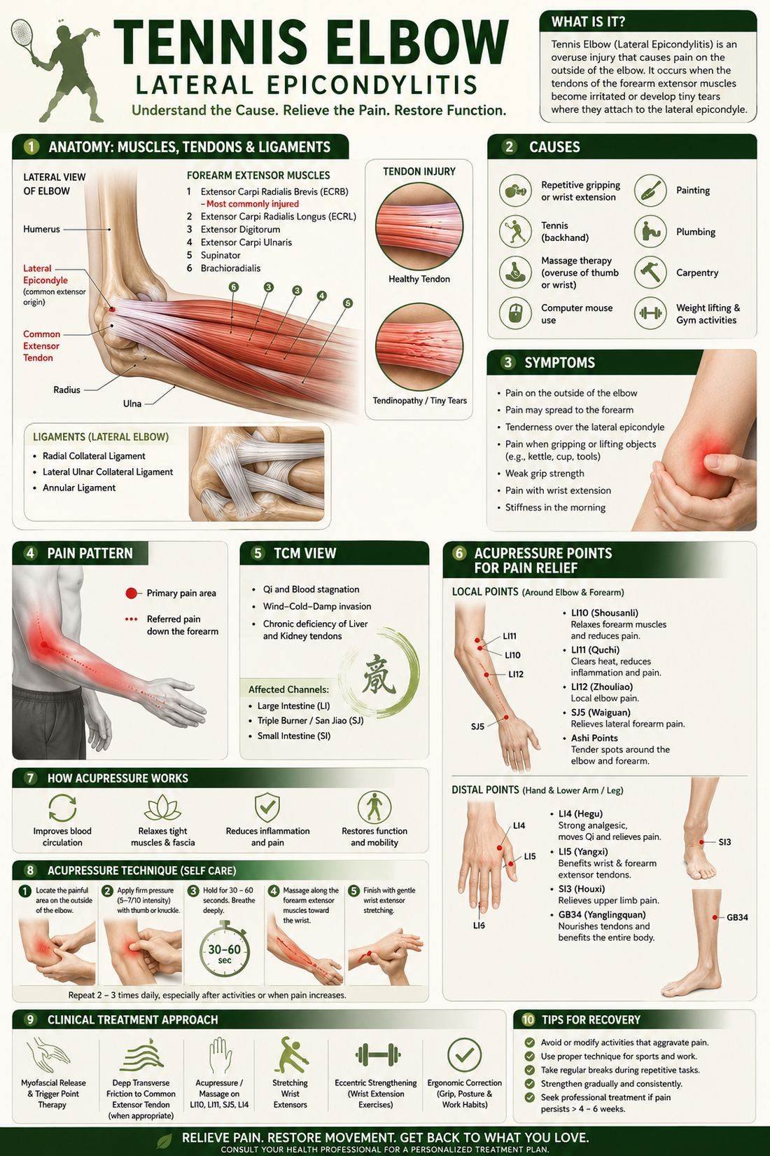 Tennis elbow (lateral epicondylitis) infographic showing forearm anatomy, causes, symptoms, pain pattern, TCM view, acupressure points and self-care technique